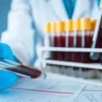 Нови тестови на крв откриваат десетина различни видови рак: Што навистина може да откријат?