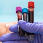 Крвна група и болести: Еве на што треба да внимаваат А, Б, АБ и 0